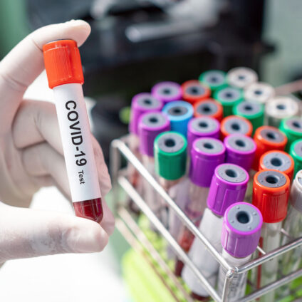 Consorzio DAFNE dona 100.000 euro a favore della Protezione Civile per la lotta al Covid-19